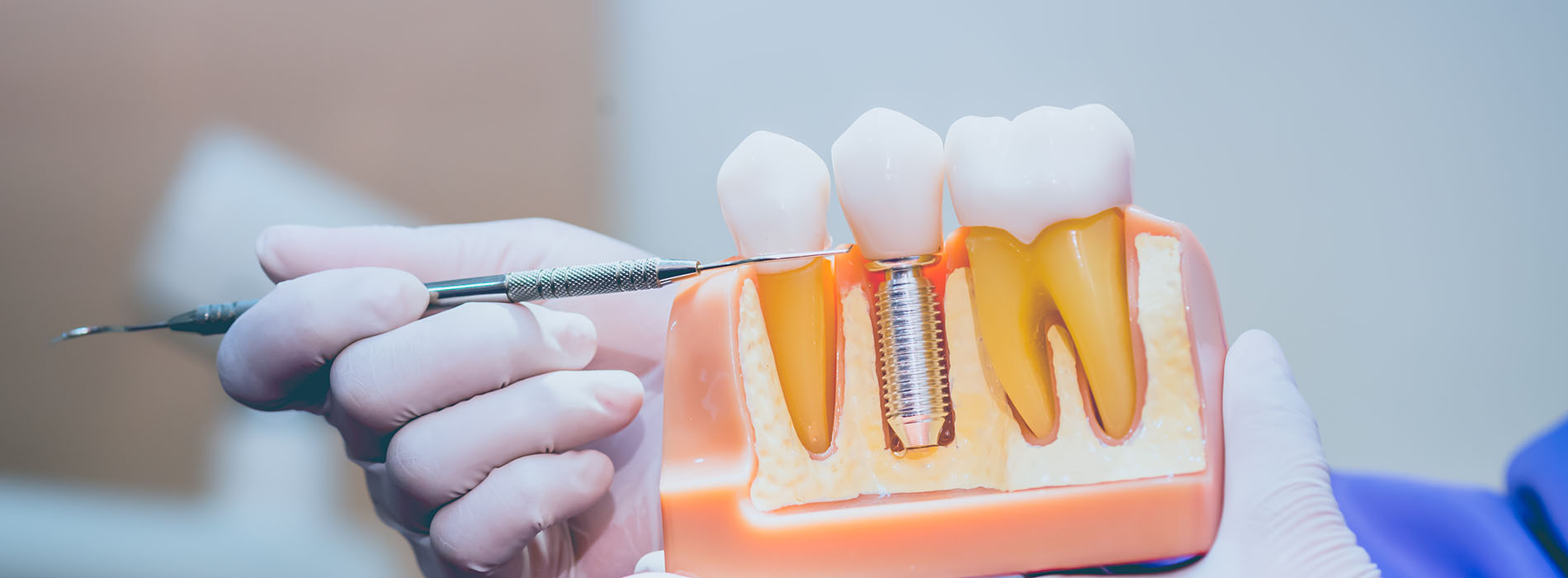 The image shows a person holding an orange object with teeth-like structures, likely in a dental or medical setting.