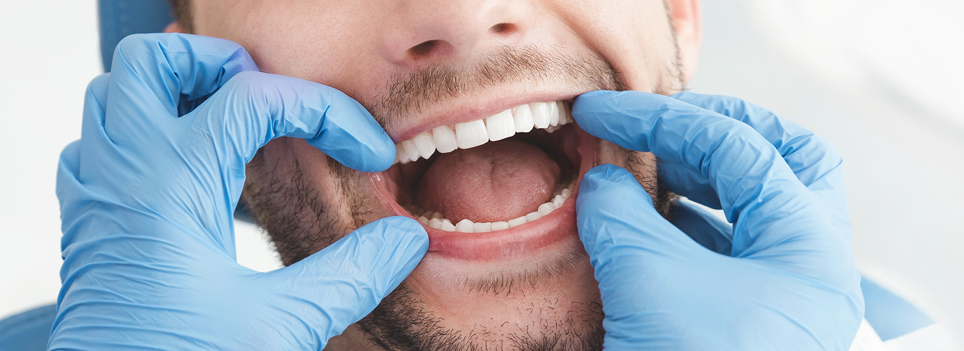 A man in a dental mask with his mouth open, holding his teeth with gloved hands.